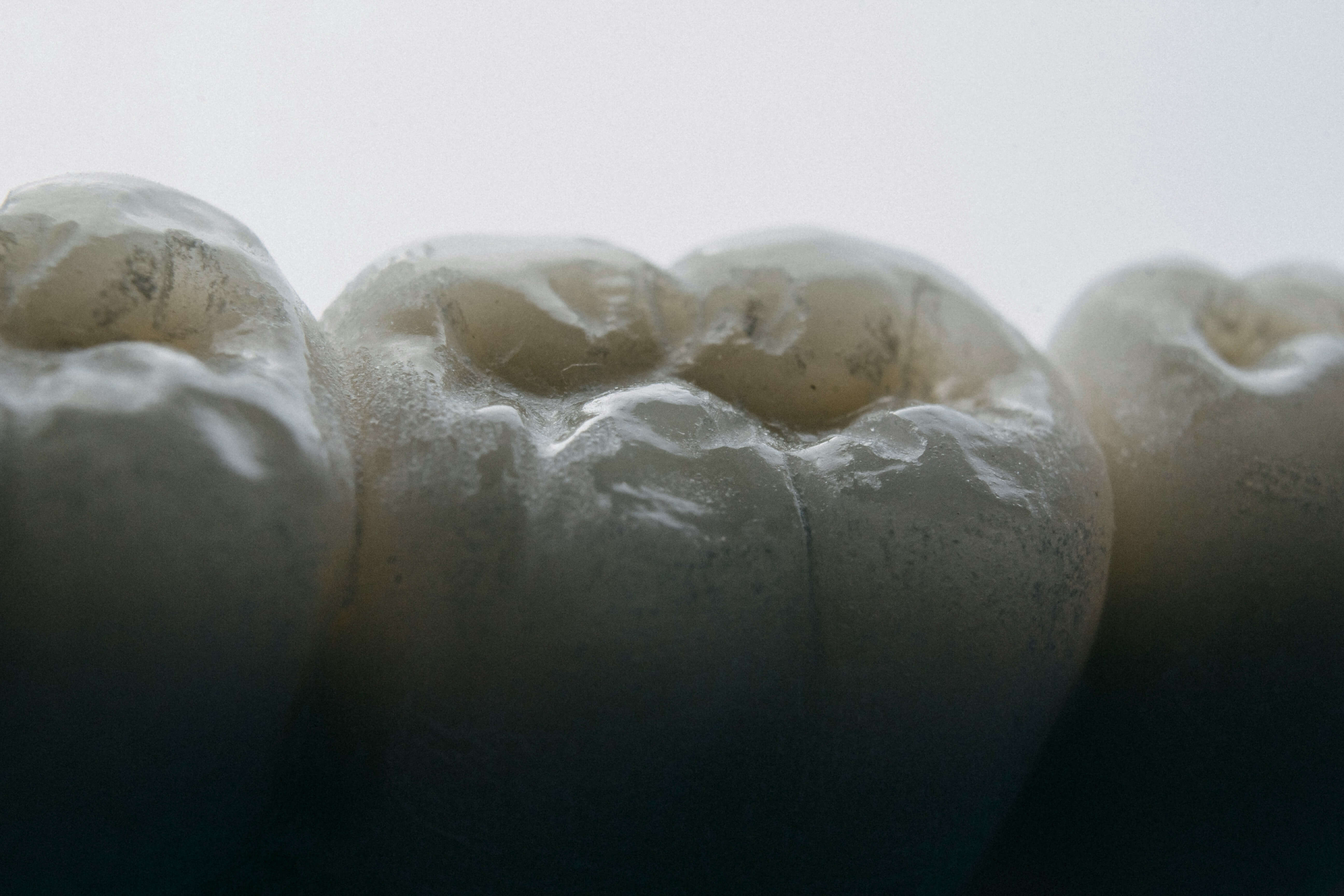 Dental treatments including cosmetic, Invisalign, and implants